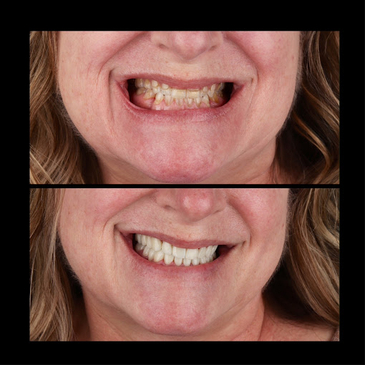 Slider image (6) The Dental Corner